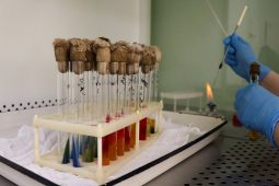 Новый масс-спектрометр в Курской областной больнице определят вид патогена за 1-2 часа