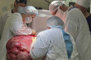 Один метр и 35 килограммов